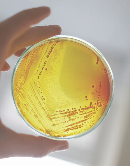 Which Honey Is Best for Health?